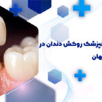 بهترین دندانپزشک روکش دندان در هفتون اصفهان