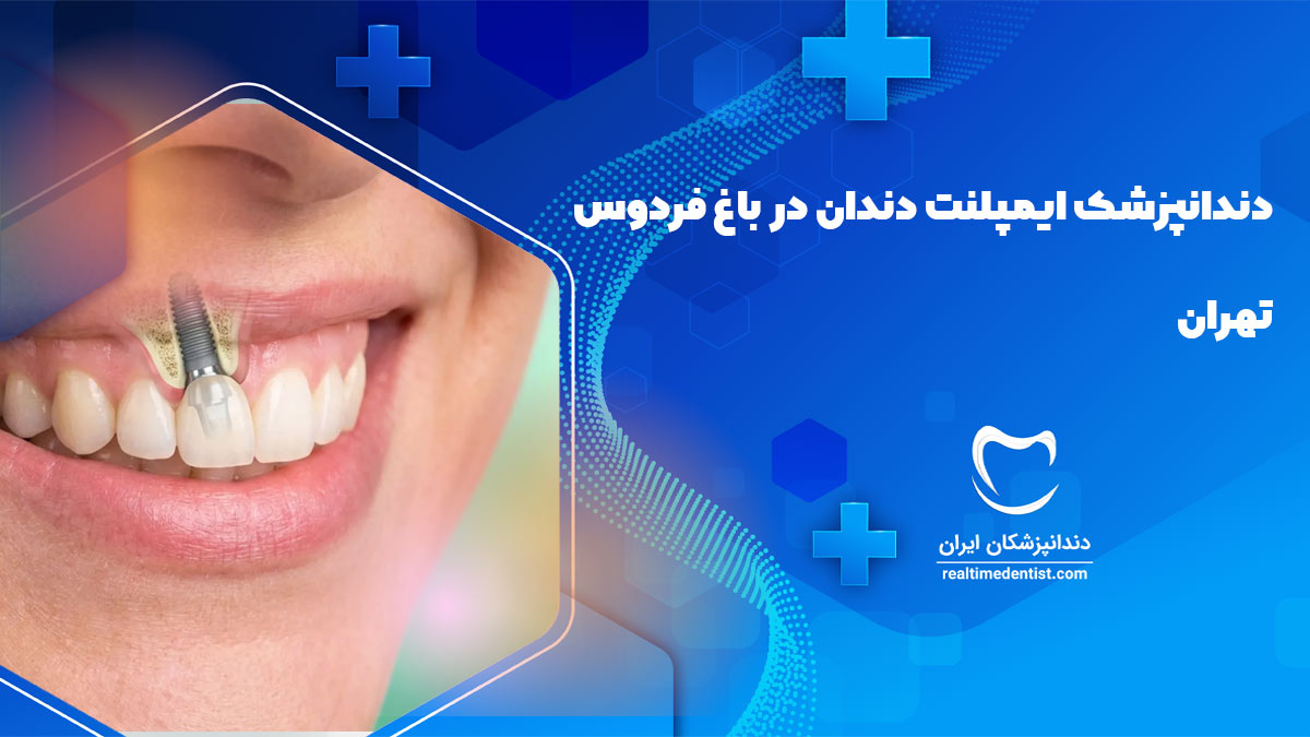 دندانپزشک ایمپلنت دندان در باغ فردوس تهران