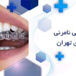 ارتودنسی نامرئی در هروی تهران