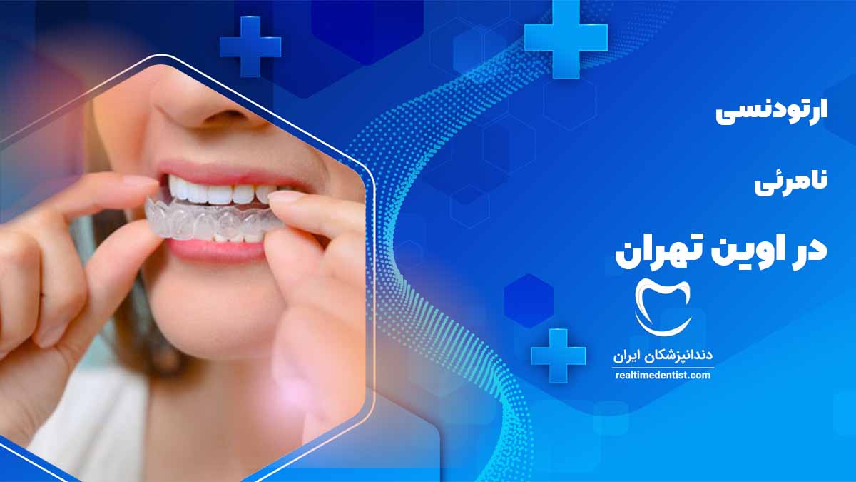 ارتودنسی نامرئی در اوین تهران