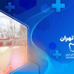 ارتودنسی نامرئی در ولنجک تهران