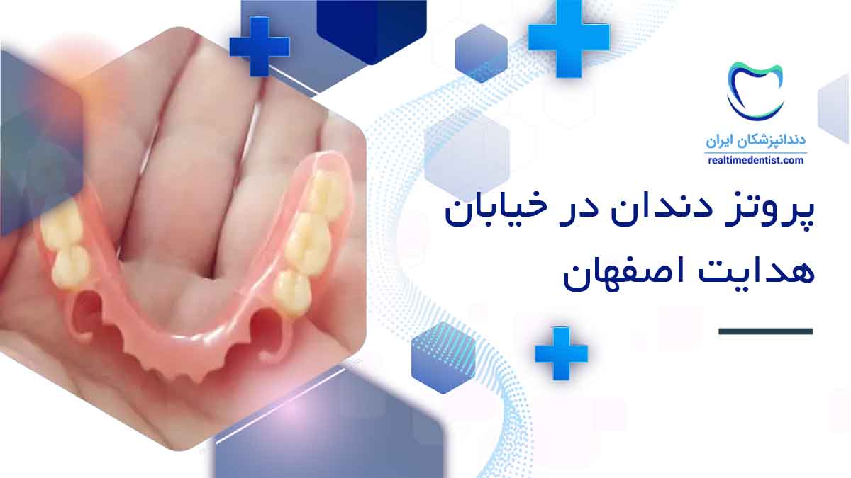 پروتز دندان در خیابان هدایت اصفهان