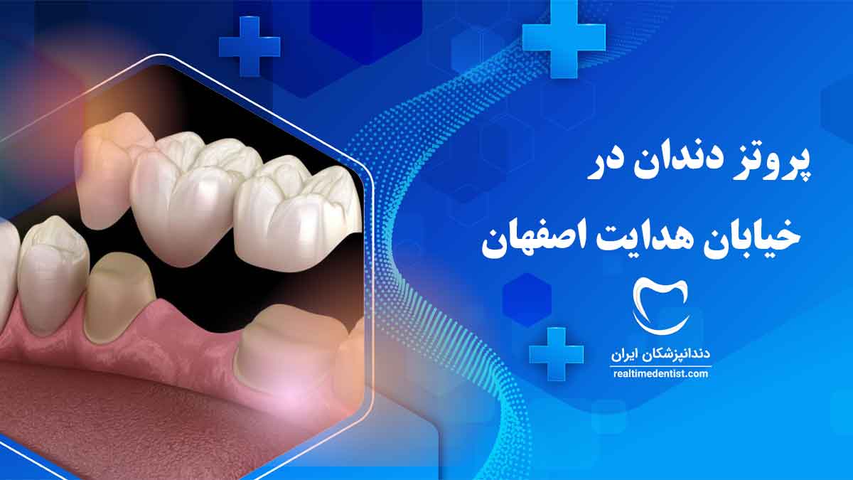 پروتز دندان در خیابان هدایت اصفهان