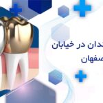 روکش دندان در خیابان هدایت اصفهان