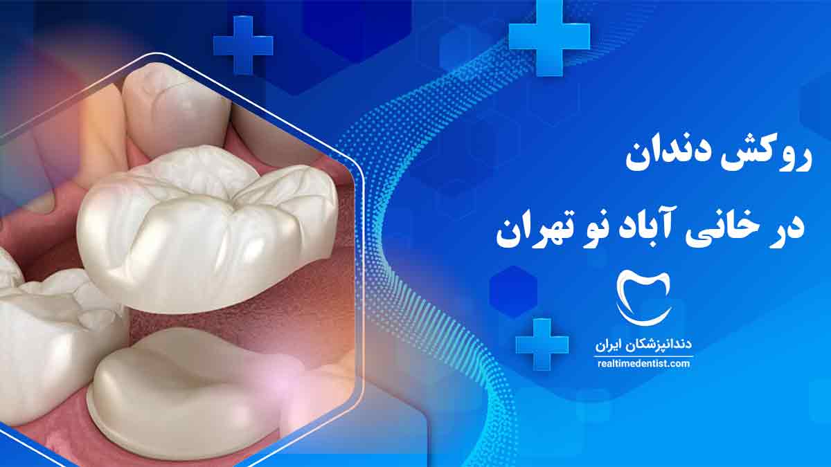 بهترین دندانپزشک روکش دندان در خانی آباد نو تهران