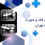 رادیولوژی فک و صورت در قیطریه تهران