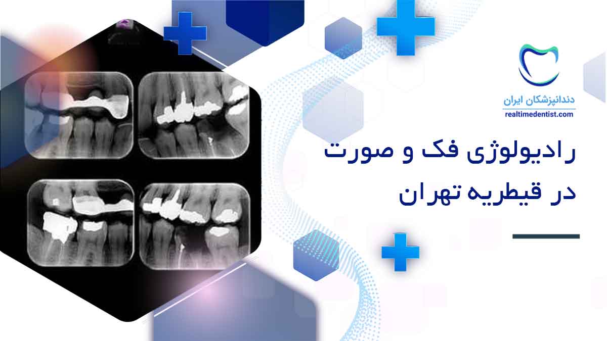 رادیولوژی فک و صورت در قیطریه تهران